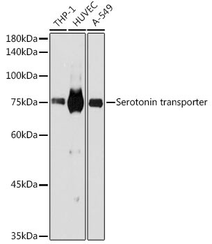 SLC6A4 Antibody in Western Blot (WB)