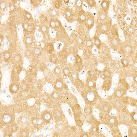 STIM1 Antibody in Immunohistochemistry (Paraffin) (IHC (P))