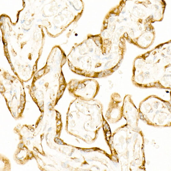 STIM1 Antibody in Immunohistochemistry (Paraffin) (IHC (P))