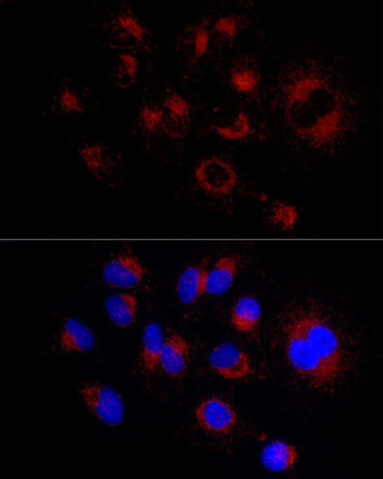 LAMP2 Antibody in Immunocytochemistry (ICC/IF)