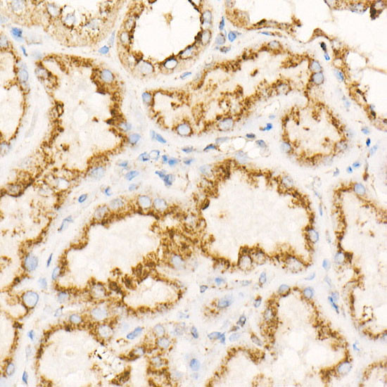 LAMP2 Antibody in Immunohistochemistry (Paraffin) (IHC (P))