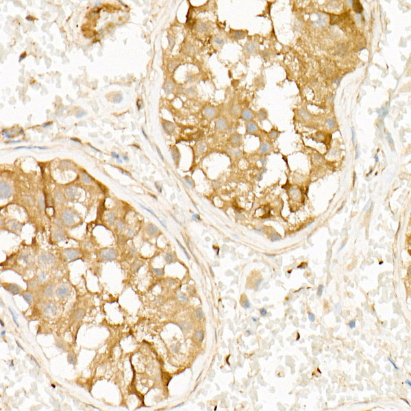 PKA beta Antibody in Immunohistochemistry (Paraffin) (IHC (P))