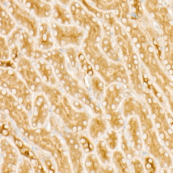 PKA beta Antibody in Immunohistochemistry (Paraffin) (IHC (P))