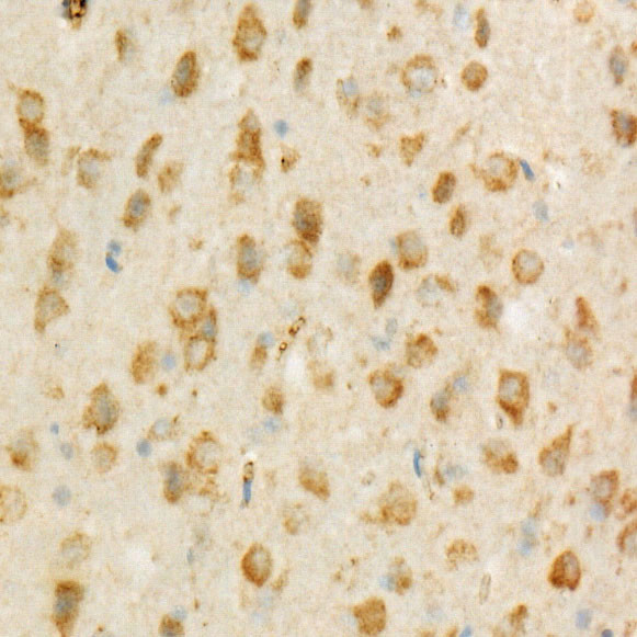 TSG101 Antibody in Immunohistochemistry (Paraffin) (IHC (P))