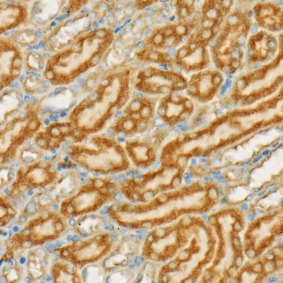 TSG101 Antibody in Immunohistochemistry (Paraffin) (IHC (P))