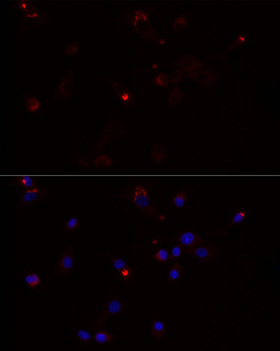 MMP3 Antibody in Immunocytochemistry (ICC/IF)