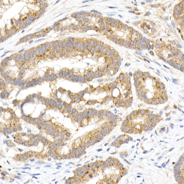 MMP3 Antibody in Immunohistochemistry (Paraffin) (IHC (P))