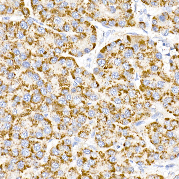 MMP3 Antibody in Immunohistochemistry (Paraffin) (IHC (P))