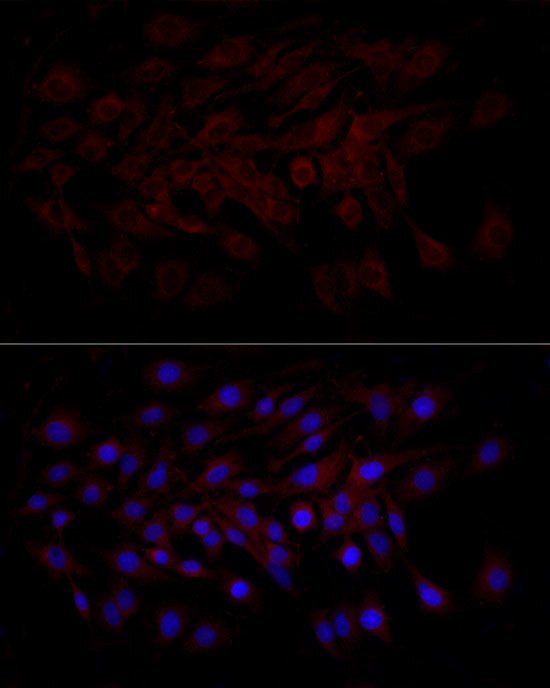 Beclin 1 Antibody in Immunocytochemistry (ICC/IF)