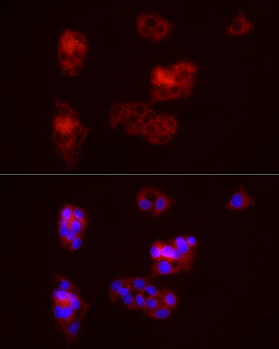 Beclin 1 Antibody in Immunocytochemistry (ICC/IF)