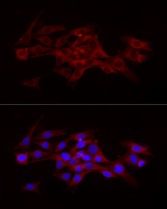 Beclin 1 Antibody in Immunocytochemistry (ICC/IF)