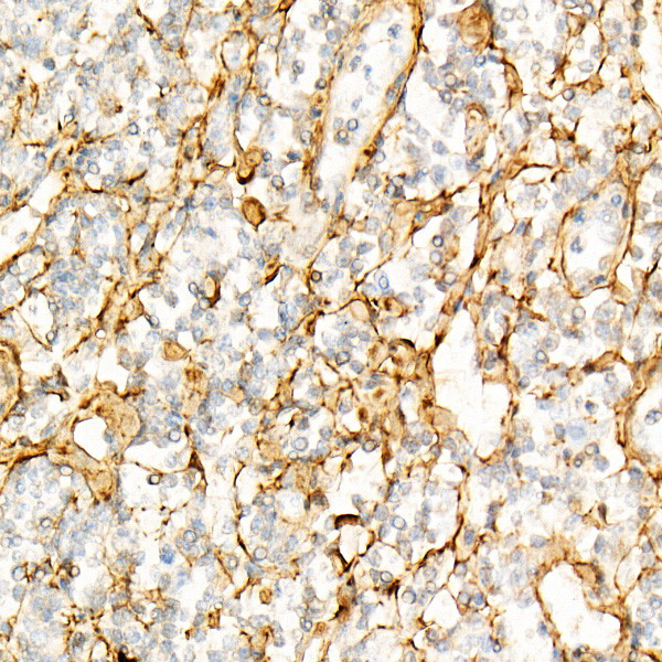 TGFBI Antibody in Immunohistochemistry (Paraffin) (IHC (P))