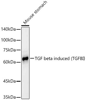 TGFBI Antibody in Western Blot (WB)