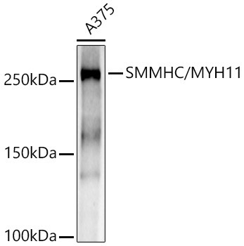 MYH11 Antibody in Western Blot (WB)