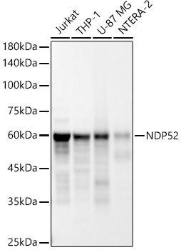 CALCOCO2 Antibody in Western Blot (WB)