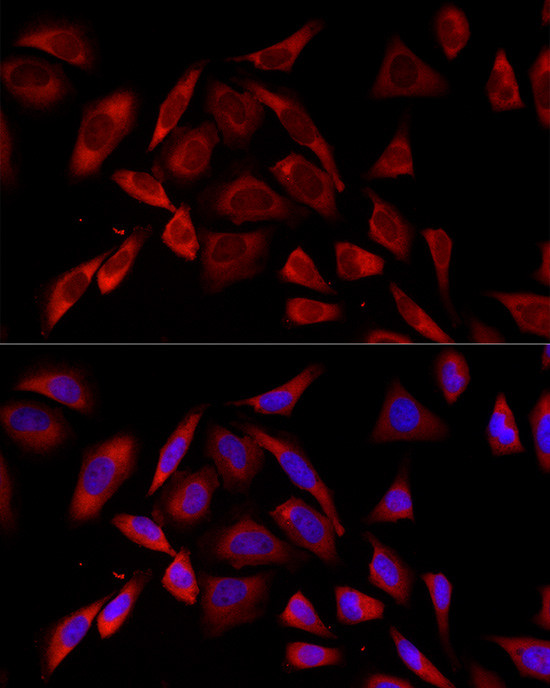 PKC alpha Antibody in Immunocytochemistry (ICC/IF)