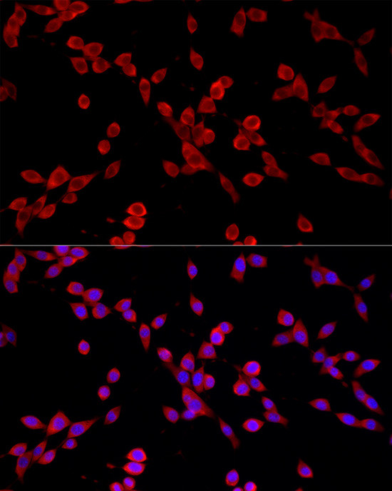 PKC alpha Antibody in Immunocytochemistry (ICC/IF)