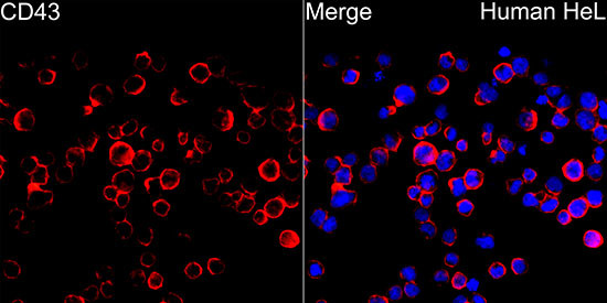 CD43 Antibody in Immunocytochemistry (ICC/IF)