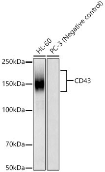 CD43 Antibody in Western Blot (WB)