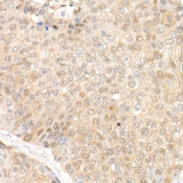 SOD1 Antibody in Immunohistochemistry (Paraffin) (IHC (P))