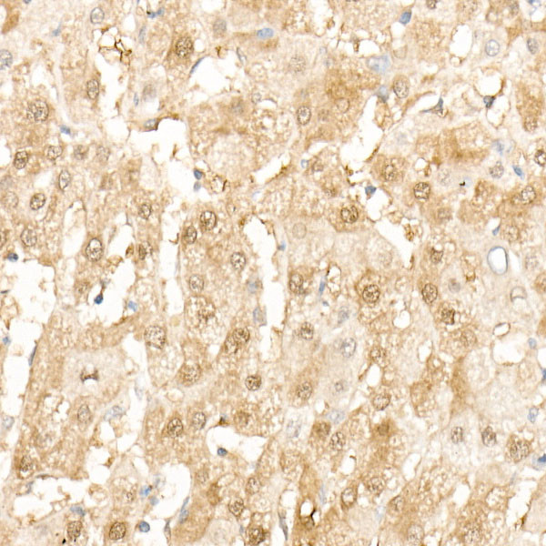 SOD1 Antibody in Immunohistochemistry (Paraffin) (IHC (P))