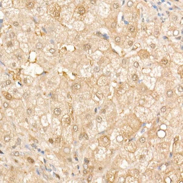 SOD1 Antibody in Immunohistochemistry (Paraffin) (IHC (P))