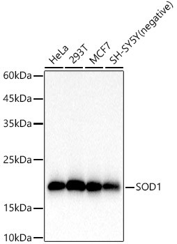 SOD1 Antibody in Western Blot (WB)