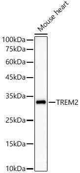 TREM2 Antibody in Western Blot (WB)