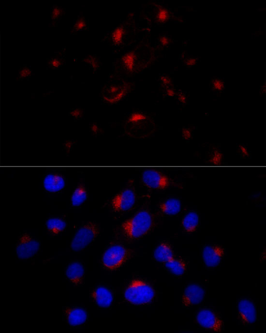 BST-2 Antibody in Immunocytochemistry (ICC/IF)