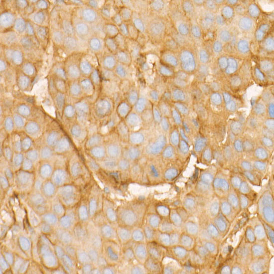 BST-2 Antibody in Immunohistochemistry (Paraffin) (IHC (P))