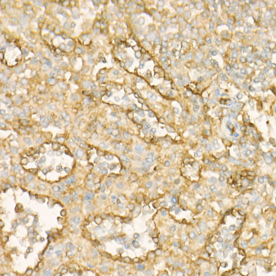 BST-2 Antibody in Immunohistochemistry (Paraffin) (IHC (P))