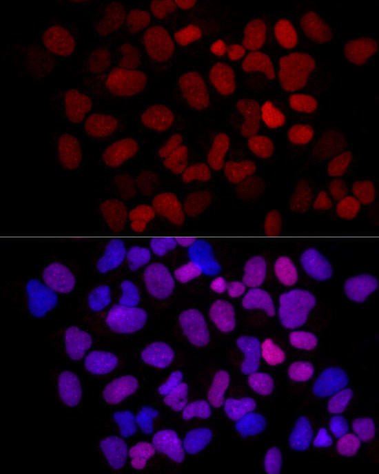 MCM2 Antibody in Immunocytochemistry (ICC/IF)