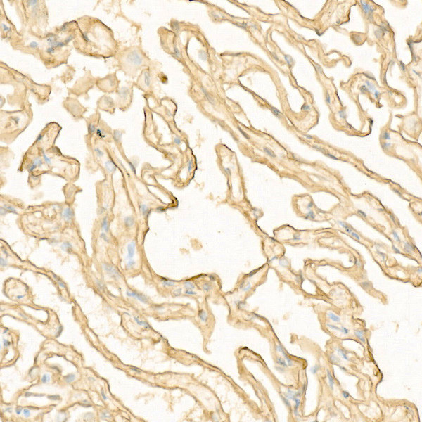 S100A10 Antibody in Immunohistochemistry (Paraffin) (IHC (P))