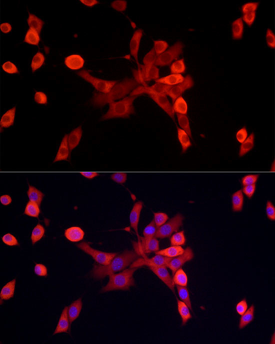 S100A10 Antibody in Immunohistochemistry (Paraffin) (IHC (P))