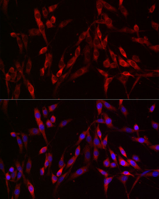 S100A10 Antibody in Immunohistochemistry (Paraffin) (IHC (P))