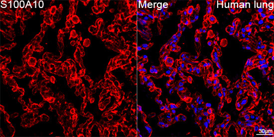 S100A10 Antibody in Immunohistochemistry (Paraffin) (IHC (P))