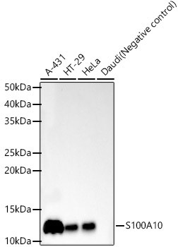 S100A10 Antibody in Western Blot (WB)