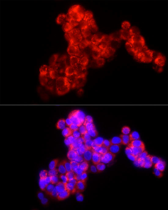 MMP2 Antibody in Immunocytochemistry (ICC/IF)