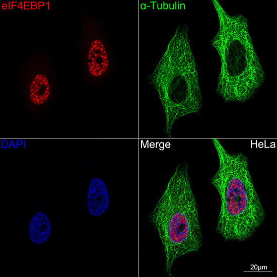 4EBP1 Antibody in Immunocytochemistry (ICC/IF)