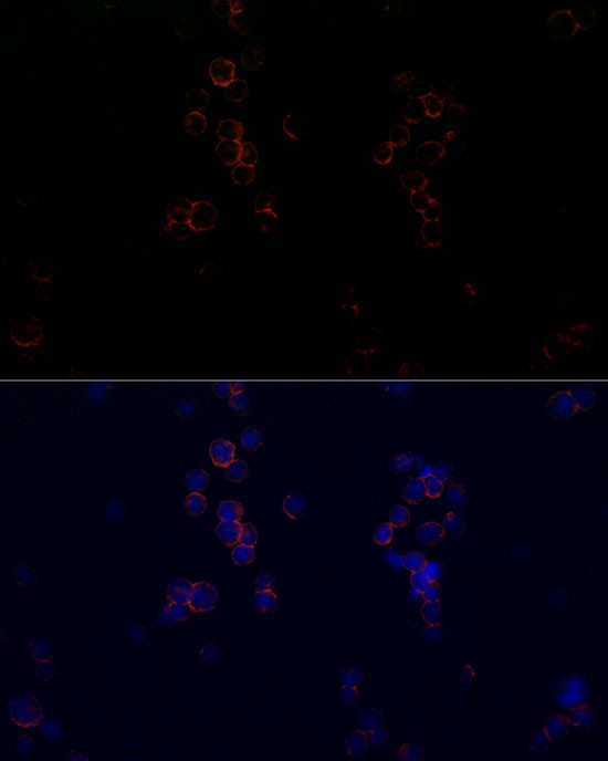 CD162 Antibody in Immunocytochemistry (ICC/IF)