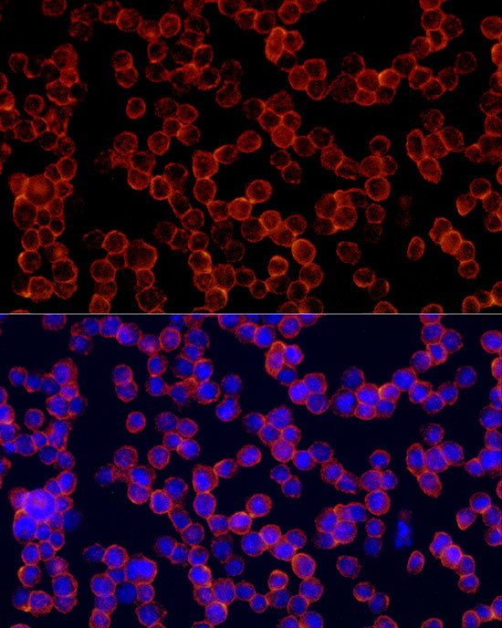 CD162 Antibody in Immunocytochemistry (ICC/IF)