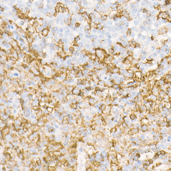 CD162 Antibody in Immunohistochemistry (Paraffin) (IHC (P))