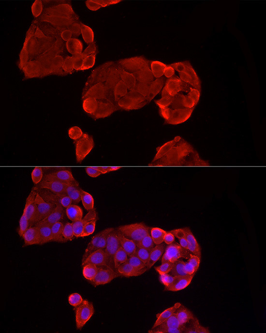 Glypican 3 Antibody in Immunocytochemistry (ICC/IF)