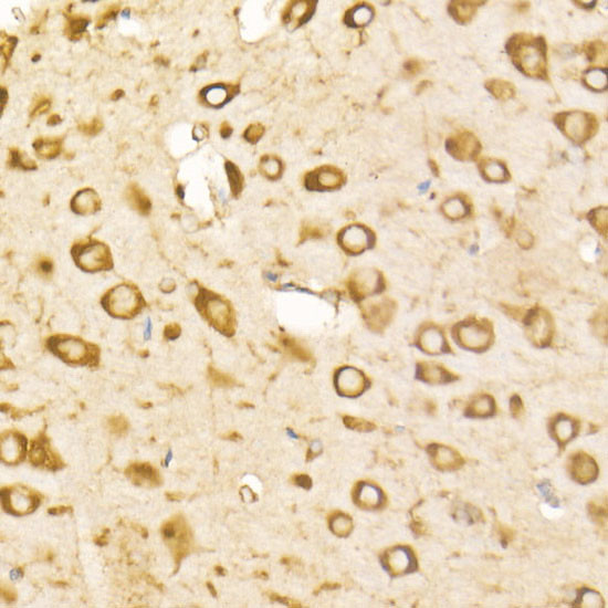 GRP78 Antibody in Immunohistochemistry (Paraffin) (IHC (P))