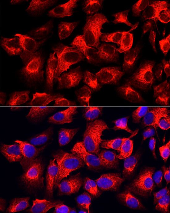 Cytokeratin 17 Antibody in Immunocytochemistry (ICC/IF)