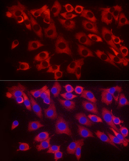 EEF1A1 Antibody in Immunocytochemistry (ICC/IF)