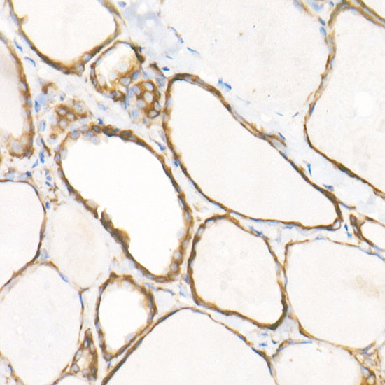 EEF1A1 Antibody in Immunohistochemistry (Paraffin) (IHC (P))