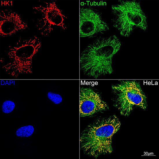 HK1 Antibody in Immunocytochemistry (ICC/IF)