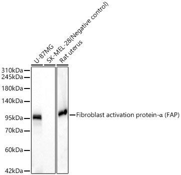 FAP Antibody in Western Blot (WB)