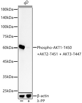 Phospho-AKT Pan (Thr450, Thr451, Thr447) Antibody in Western Blot (WB)